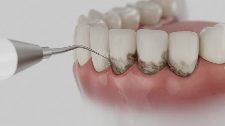 Reliable Dental Implants contractor in Ridgewood, IL by Smile Center Dentistry